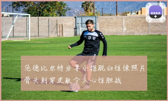 范德比尔特分享小指脱臼惊悚照片骨头刺穿皮肤令人心惊胆战